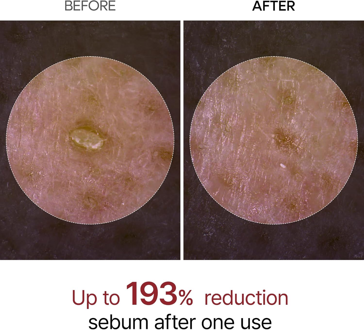 Dr.Melaxin Peel Shot Glow Black Rice Peeling Ampoule Soft Exfoliating Face And Body Scrub Dead Skin Cells Blackheads Remover For All Skin Types Korean Skin Care 80Ml