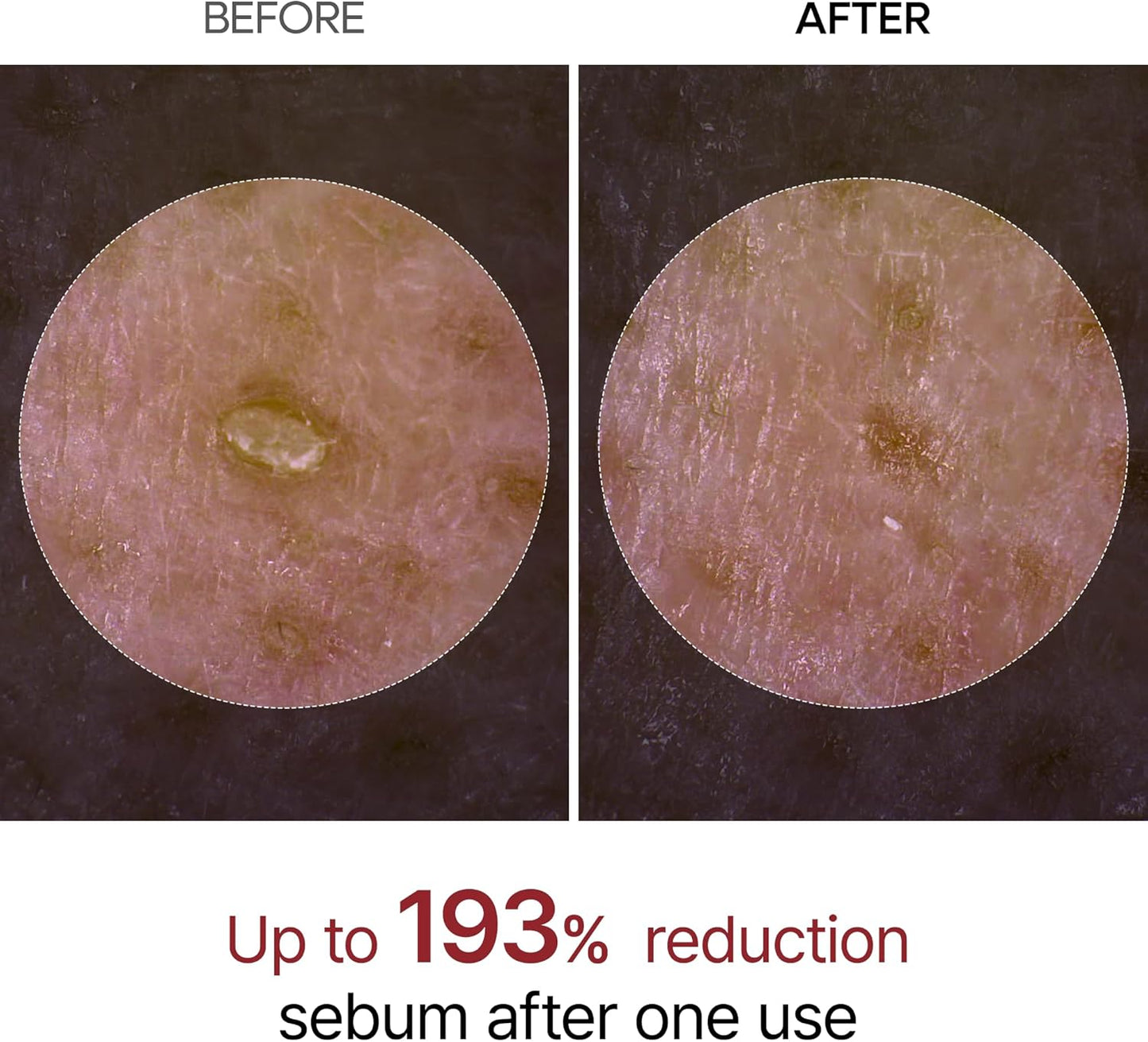 Dr.Melaxin Peel Shot Glow Black Rice Peeling Ampoule Soft Exfoliating Face And Body Scrub Dead Skin Cells Blackheads Remover For All Skin Types Korean Skin Care 80Ml