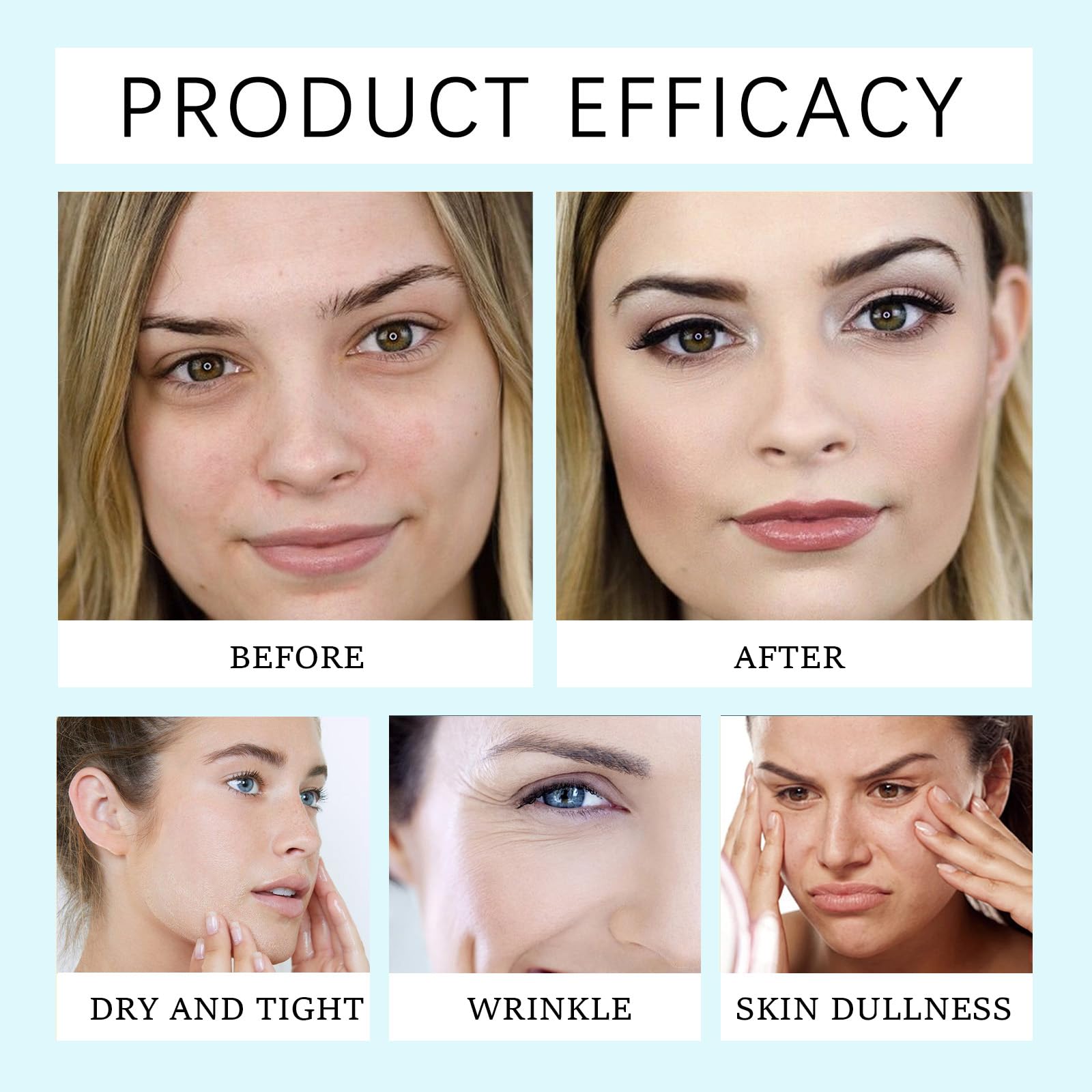 Centella Skin Care Face Moisturizer - Ultimate Moisturizing Cream for Women, Relieves Dry Complexion, Anti Wrinkle Face Care, Suitable for All Skin Types, 100ML