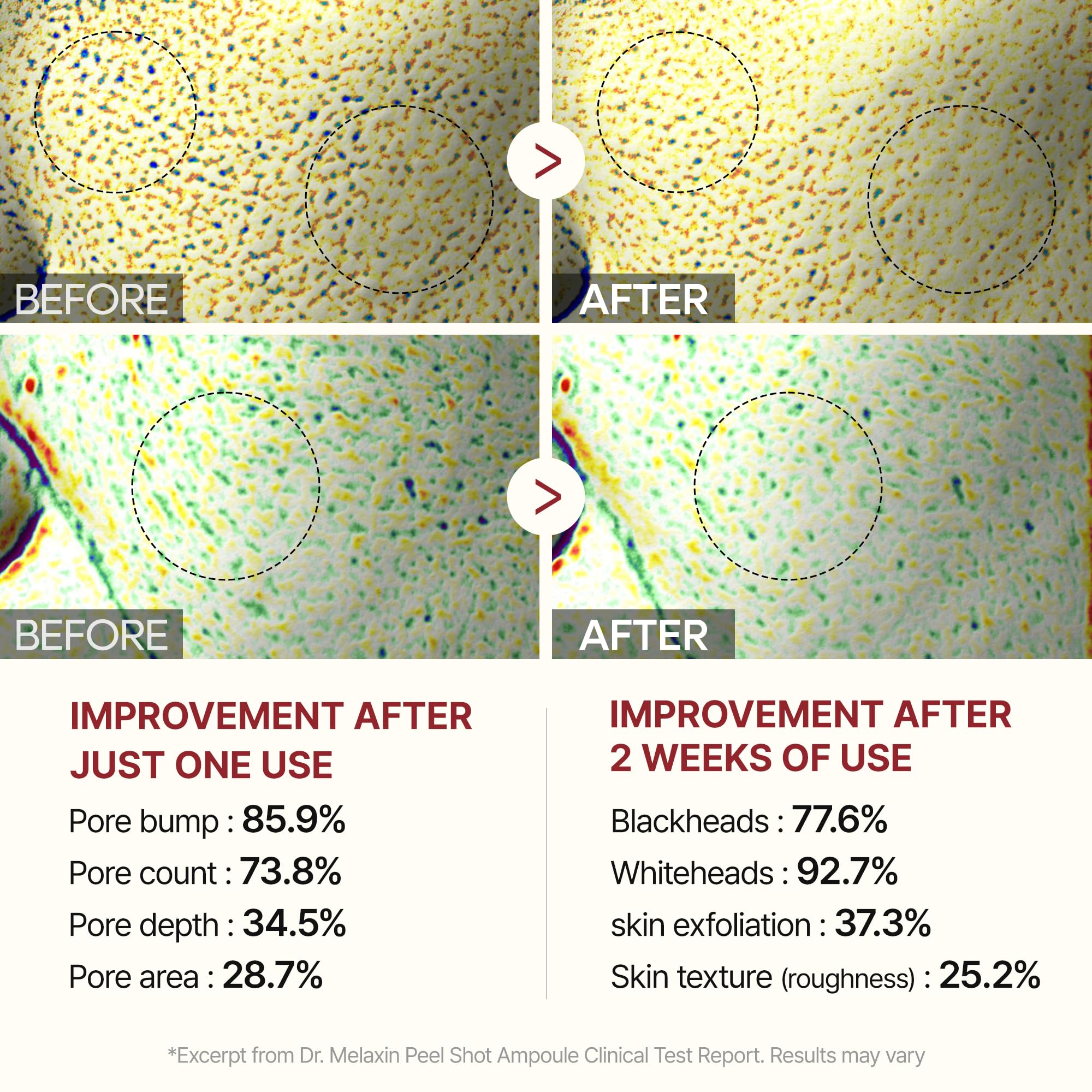 Dr.Melaxin Peel Shot Glow White Rice Peeling Ampoule Soft Exfoliating Face And Body Scrub Dead Skin Cells Remover For All Skin Types Korean Skin Care 80Ml