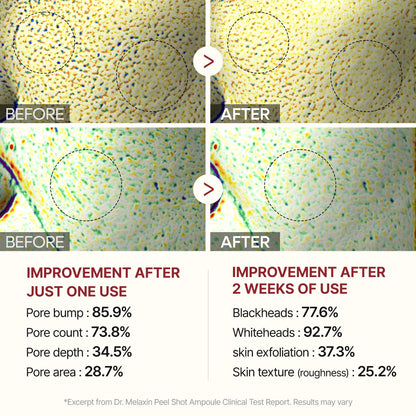 Dr.Melaxin Peel Shot Glow White Rice Peeling Ampoule Soft Exfoliating Face And Body Scrub Dead Skin Cells Remover For All Skin Types Korean Skin Care 80Ml